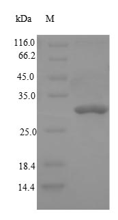 Recombinant Rat Dipeptidyl peptidase 4(Dpp4),partial